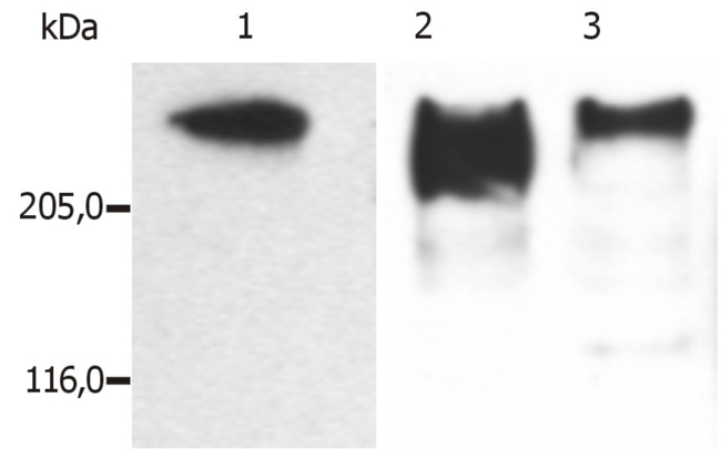 MAP2 Antibody - Western Blotting analysis (reducing conditions) of microtubules partially purified from porcine brain lysate.  Lane 1: immunostaining with anti-MAP2ab (MT-01)  Lane 2: immunostaining with anti-MAP2ab (MT-07)  Lane 3: immunostaining with anti-MAP2ab (MT-08)