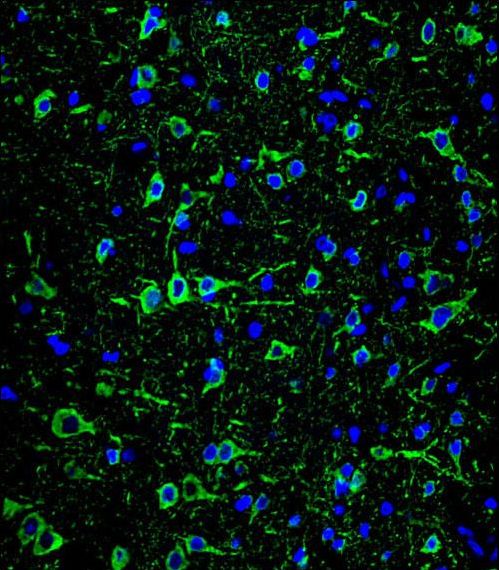 MAP2 Antibody - Confocal immunofluorescence of MAP2 Antibody with brain tissue followed by Alexa Fluor 488-conjugated goat anti-mouse lgG (green). DAPI was used to stain the cell nuclear (blue).