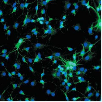 MAP2 Antibody - Immunofluorescent staining of MAP2 antibody. Dissociated cell cultures of an e13 mouse brain showing MAP-2 (green staining) of neurons. DAPI (blue staining) allows visualization of nuclei.