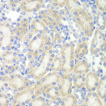 MAP2 Antibody - Immunohistochemistry of paraffin-embedded rat kidney using MAP2 antibodyat dilution of 1:200 (40x lens).