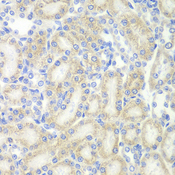 MAP2 Antibody - Immunohistochemistry of paraffin-embedded rat kidney tissue.