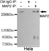 MAP2 Antibody - Immunoprecipitation analysis of HeLa cell lysates using MAP2 (N-terminus) mouse monoclonal antibody.