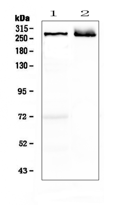 MAP2 Antibody - Western blot analysis of MAP2 using anti-MAP2 antibody. Electrophoresis was performed on a 5-20% SDS-PAGE gel at 70V (Stacking gel) / 90V (Resolving gel) for 2-3 hours. The sample well of each lane was loaded with 50ug of sample under reducing conditions. Lane 1: rat brain tissue lysates,Lane 2: mouse brain tissue lysates. After Electrophoresis, proteins were transferred to a Nitrocellulose membrane at 150mA for 50-90 minutes. Blocked the membrane with 5% Non-fat Milk/ TBS for 1.5 hour at RT. The membrane was incubated with rabbit anti-MAP2 antigen affinity purified polyclonal antibody at 0.5 µg/mL overnight at 4°C, then washed with TBS-0.1% Tween 3 times with 5 minutes each and probed with a goat anti-rabbit IgG-HRP secondary antibody at a dilution of 1:10000 for 1.5 hour at RT. The signal is developed using an Enhanced Chemiluminescent detection (ECL) kit with Tanon 5200 system. A specific band was detected for MAP2 at approximately 280KD. The expected band size for MAP2 is at 199KD.