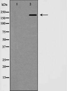 MAP2 Antibody - Western blot analysis of MAP2 expression in mouse brain. The lane on the left is treated with the antigen-specific peptide.