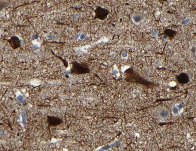 MAP2 Antibody - 1:100 staining MAP2 in human brain by IHC using paraffin-embedded tissue