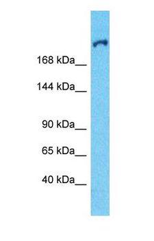 MAP2 Antibody - Western blot of MAP2 Antibody with human MCF7 Whole Cell lysate.  This image was taken for the unconjugated form of this product. Other forms have not been tested.