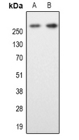 MAP2 Antibody - Western blot analysis of MAP2 expression in SKNSH (A); mouse brain (B) whole cell lysates.