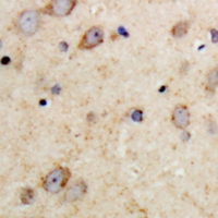 MAP2 Antibody - Immunohistochemical analysis of MAP2 staining in human brain formalin fixed paraffin embedded tissue section. The section was pre-treated using heat mediated antigen retrieval with sodium citrate buffer (pH 6.0). The section was then incubated with the antibody at room temperature and detected with HRP and DAB as chromogen. The section was then counterstained with hematoxylin and mounted with DPX.