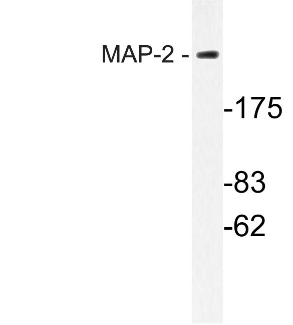 MAP2 Antibody - Western blot of MAP-2 (W14) pAb in extracts from mouse brain cells.