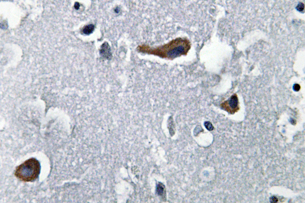 MAP2 Antibody - IHC of MAP-2 (W14) pAb in paraffin-embedded human brain tissue.