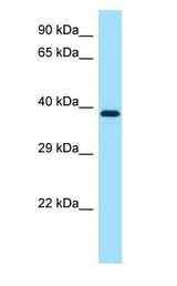 MAP2K1 / MKK1 / MEK1 Antibody - MAP2K1 / MEK1 antibody Western Blot using Mouse Small Intestine Lysate at 1ug/ml..  This image was taken for the unconjugated form of this product. Other forms have not been tested.