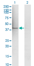 MAP2K1 / MKK1 / MEK1 Antibody - Western Blot analysis of MAP2K1 expression in transfected 293T cell line by MAP2K1 monoclonal antibody (M01), clone 1B5.Lane 1: MAP2K1 transfected lysate (Predicted MW: 43.439 KDa).Lane 2: Non-transfected lysate.