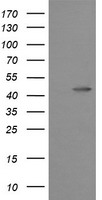 MAP2K1 / MKK1 / MEK1 Antibody - HEK293T cells were transfected with the pCMV6-ENTRY control (Left lane) or pCMV6-ENTRY MAP2K1 (Right lane) cDNA for 48 hrs and lysed. Equivalent amounts of cell lysates (5 ug per lane) were separated by SDS-PAGE and immunoblotted with anti-MAP2K1.