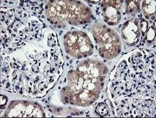 MAP2K1 / MKK1 / MEK1 Antibody - IHC of paraffin-embedded Human Kidney tissue using anti-MAP2K1 mouse monoclonal antibody.