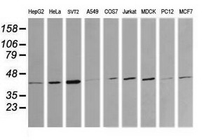 MAP2K1 / MKK1 / MEK1 Antibody - Western blot of extracts (35 ug) from 9 different cell lines by using anti-MAP2K1 monoclonal antibody (HepG2: human; HeLa: human; SVT2: mouse; A549: human; COS7: monkey; Jurkat: human; MDCK: canine; PC12: rat; MCF7: human).
