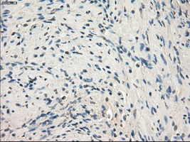 MAP2K1 / MKK1 / MEK1 Antibody - Immunohistochemical staining of paraffin-embedded prostate tissue using anti-MAP2K1 mouse monoclonal antibody. (Dilution 1:50).