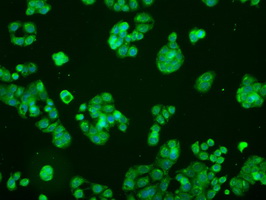 MAP2K1 / MKK1 / MEK1 Antibody - Immunofluorescent staining of HT29 cells using anti-MAP2K1 mouse monoclonal antibody.