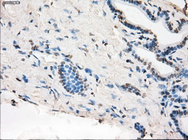 MAP2K1 / MKK1 / MEK1 Antibody - Immunohistochemical staining of paraffin-embedded pancreas tissue using anti-MAP2K1 mouse monoclonal antibody. (Dilution 1:50).