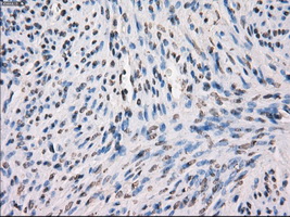 MAP2K1 / MKK1 / MEK1 Antibody - Immunohistochemical staining of paraffin-embedded endometrium tissue using anti-MAP2K1 mouse monoclonal antibody. (Dilution 1:50).