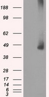 MAP2K1 / MKK1 / MEK1 Antibody - HEK293T cells were transfected with the pCMV6-ENTRY control (Left lane) or pCMV6-ENTRY MAP2K1 (Right lane) cDNA for 48 hrs and lysed. Equivalent amounts of cell lysates (5 ug per lane) were separated by SDS-PAGE and immunoblotted with anti-MAP2K1.