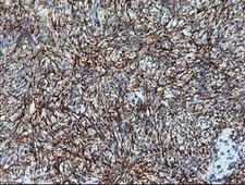 MAP2K1 / MKK1 / MEK1 Antibody - IHC of paraffin-embedded Human Ovary tissue using anti-MAP2K1 mouse monoclonal antibody. (Heat-induced epitope retrieval by 10mM citric buffer, pH6.0, 120°C for 3min).