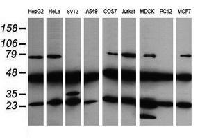 MAP2K1 / MKK1 / MEK1 Antibody - Western blot of extracts (35 ug) from 9 different cell lines by using g anti-MAP2K1 monoclonal antibody (HepG2: human; HeLa: human; SVT2: mouse; A549: human; COS7: monkey; Jurkat: human; MDCK: canine; PC12: rat; MCF7: human).