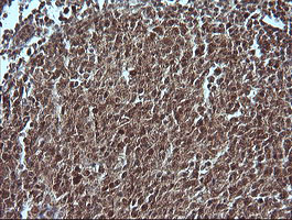 MAP2K1 / MKK1 / MEK1 Antibody - IHC of paraffin-embedded Human tonsil using anti-MAP2K1 mouse monoclonal antibody.