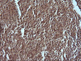 MAP2K1 / MKK1 / MEK1 Antibody - IHC of paraffin-embedded Human tonsil using anti-MAP2K1 mouse monoclonal antibody.