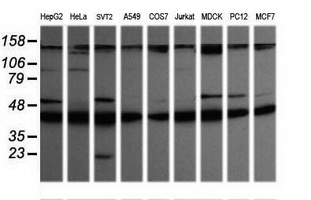 MAP2K1 / MKK1 / MEK1 Antibody - Western blot of extracts (35 ug) from 9 different cell lines by using g anti-MAP2K1 monoclonal antibody (HepG2: human; HeLa: human; SVT2: mouse; A549: human; COS7: monkey; Jurkat: human; MDCK: canine; PC12: rat; MCF7: human).