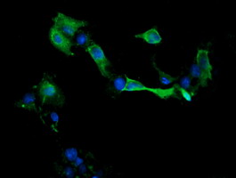 MAP2K1 / MKK1 / MEK1 Antibody - Anti-MAP2K1 mouse monoclonal antibody immunofluorescent staining of COS7 cells transiently transfected by pCMV6-ENTRY MAP2K1.
