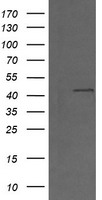 MAP2K1 / MKK1 / MEK1 Antibody - HEK293T cells were transfected with the pCMV6-ENTRY control (Left lane) or pCMV6-ENTRY MAP2K1 (Right lane) cDNA for 48 hrs and lysed. Equivalent amounts of cell lysates (5 ug per lane) were separated by SDS-PAGE and immunoblotted with anti-MAP2K1.