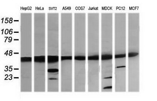 MAP2K1 / MKK1 / MEK1 Antibody - Western blot of extracts (35ug) from 9 different cell lines by using anti-MAP2K1 monoclonal antibody (HepG2: human; HeLa: human; SVT2: mouse; A549: human; COS7: monkey; Jurkat: human; MDCK: canine; PC12: rat; MCF7: human).