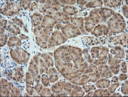 MAP2K1 / MKK1 / MEK1 Antibody - IHC of paraffin-embedded Human pancreas tissue using anti-MAP2K1 mouse monoclonal antibody. (Heat-induced epitope retrieval by 10mM citric buffer, pH6.0, 120°C for 3min).