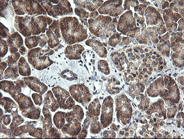 MAP2K1 / MKK1 / MEK1 Antibody - IHC of paraffin-embedded Human pancreas tissue using anti-MAP2K1 mouse monoclonal antibody. (Heat-induced epitope retrieval by 10mM citric buffer, pH6.0, 120°C for 3min).