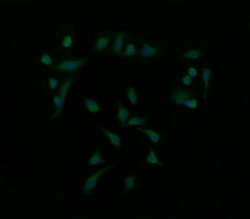 MAP2K1 / MKK1 / MEK1 Antibody - Immunofluorescent staining of HeLa cells using anti-MAP2K1 mouse monoclonal antibody.