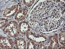 MAP2K1 / MKK1 / MEK1 Antibody - IHC of paraffin-embedded Human Kidney tissue using anti-MAP2K1 mouse monoclonal antibody.