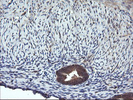 MAP2K1 / MKK1 / MEK1 Antibody - IHC of paraffin-embedded Human endometrium tissue using anti-MAP2K1 mouse monoclonal antibody.