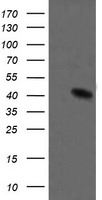 MAP2K1 / MKK1 / MEK1 Antibody - HEK293T cells were transfected with the pCMV6-ENTRY control (Left lane) or pCMV6-ENTRY MAP2K1 (Right lane) cDNA for 48 hrs and lysed. Equivalent amounts of cell lysates (5 ug per lane) were separated by SDS-PAGE and immunoblotted with anti-MAP2K1.