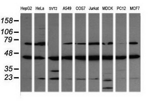 MAP2K1 / MKK1 / MEK1 Antibody - Western blot of extracts (35ug) from 9 different cell lines by using anti-MAP2K1 monoclonal antibody (HepG2: human; HeLa: human; SVT2: mouse; A549: human; COS7: monkey; Jurkat: human; MDCK: canine; PC12: rat; MCF7: human).