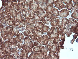 MAP2K1 / MKK1 / MEK1 Antibody - IHC of paraffin-embedded Human pancreas tissue using anti-MAP2K1 mouse monoclonal antibody. (Heat-induced epitope retrieval by 10mM citric buffer, pH6.0, 120°C for 3min).