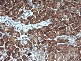 MAP2K1 / MKK1 / MEK1 Antibody - IHC of paraffin-embedded Human pancreas tissue using anti-MAP2K1 mouse monoclonal antibody.