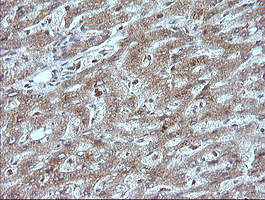 MAP2K1 / MKK1 / MEK1 Antibody - IHC of paraffin-embedded Human liver tissue using anti-MAP2K1 mouse monoclonal antibody.