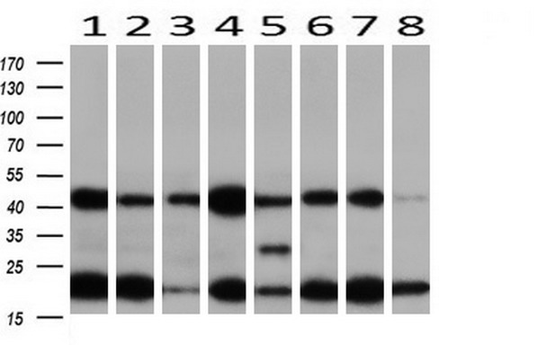 MAP2K1 / MKK1 / MEK1 Antibody - Western blot of extracts (10ug) from 8 Human tissue by using anti-MAP2K1 monoclonal antibody at 1:200 (1: Testis; 2: Uterus; 3: Breast; 4: Brain; 5: Liver; 6: Ovary; 7: Thyroid gland; 8: Colon).