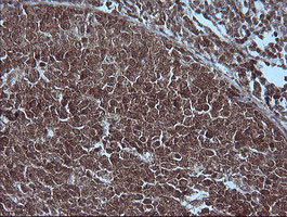 MAP2K1 / MKK1 / MEK1 Antibody - IHC of paraffin-embedded Human tonsil using anti-MAP2K1 mouse monoclonal antibody.