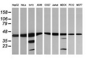MAP2K1 / MKK1 / MEK1 Antibody - Western blot of extracts (35ug) from 9 different cell lines by using anti-MAP2K1 monoclonal antibody (HepG2: human; HeLa: human; SVT2: mouse; A549: human; COS7: monkey; Jurkat: human; MDCK: canine; PC12: rat; MCF7: human).