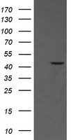 MAP2K1 / MKK1 / MEK1 Antibody - HEK293T cells were transfected with the pCMV6-ENTRY control (Left lane) or pCMV6-ENTRY MAP2K1 (Right lane) cDNA for 48 hrs and lysed. Equivalent amounts of cell lysates (5 ug per lane) were separated by SDS-PAGE and immunoblotted with anti-MAP2K1.