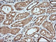 MAP2K1 / MKK1 / MEK1 Antibody - IHC of paraffin-embedded Human Kidney tissue using anti-MAP2K1 mouse monoclonal antibody. (Heat-induced epitope retrieval by 10mM citric buffer, pH6.0, 120°C for 3min).