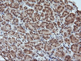 MAP2K1 / MKK1 / MEK1 Antibody - IHC of paraffin-embedded Human pancreas tissue using anti-MAP2K1 mouse monoclonal antibody. (Heat-induced epitope retrieval by 10mM citric buffer, pH6.0, 120°C for 3min).