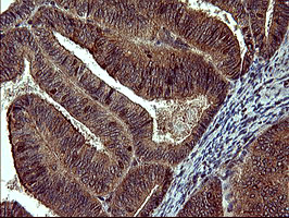 MAP2K1 / MKK1 / MEK1 Antibody - IHC of paraffin-embedded Human prostate tissue using anti-MAP2K1 mouse monoclonal antibody. (Heat-induced epitope retrieval by 10mM citric buffer, pH6.0, 120°C for 3min).