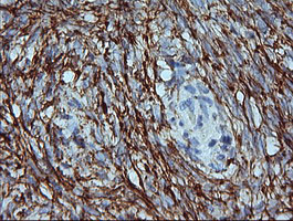 MAP2K1 / MKK1 / MEK1 Antibody - IHC of paraffin-embedded Human Ovary tissue using anti-MAP2K1 mouse monoclonal antibody.